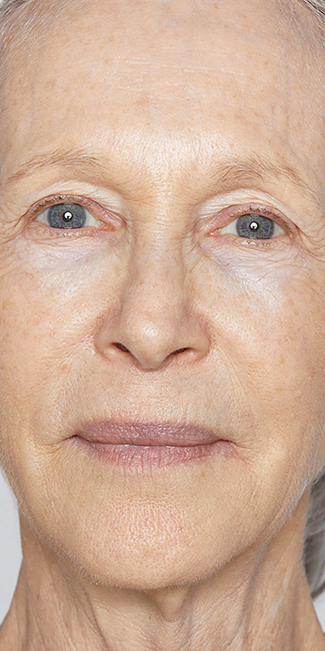 Clinical study after: Clinical study after image