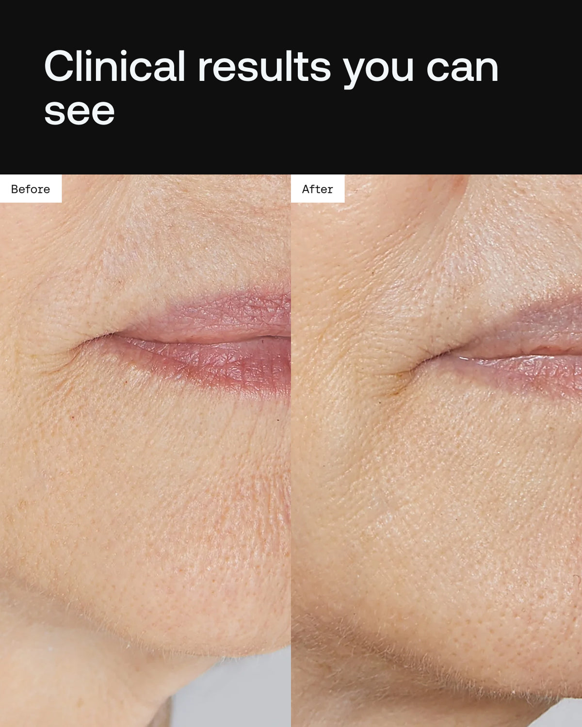 Cell Forté Serum | Human Stem Cell Conditioned Media