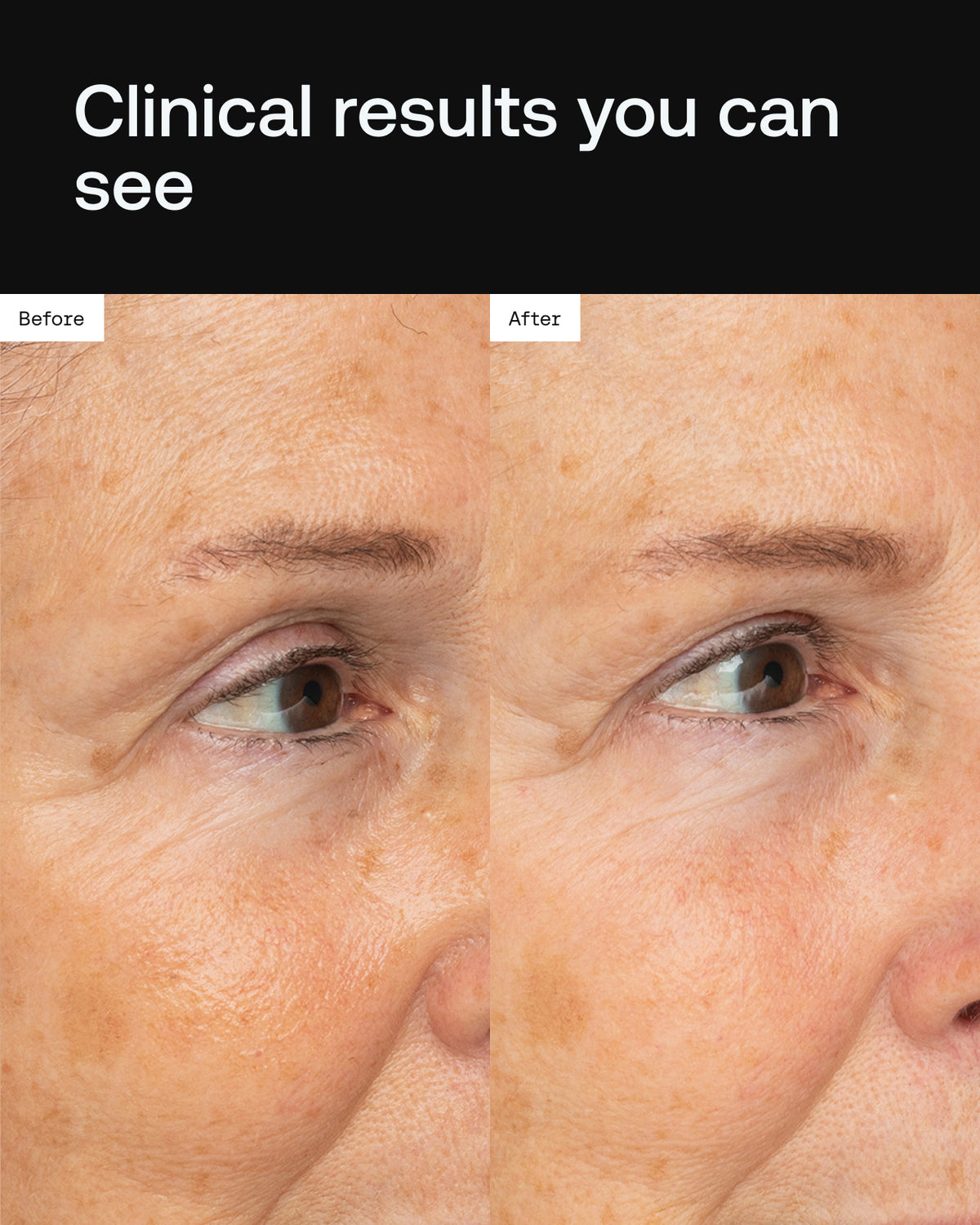 Cell Forté Eye Crème | Patent-Pending HDSC™ Technology