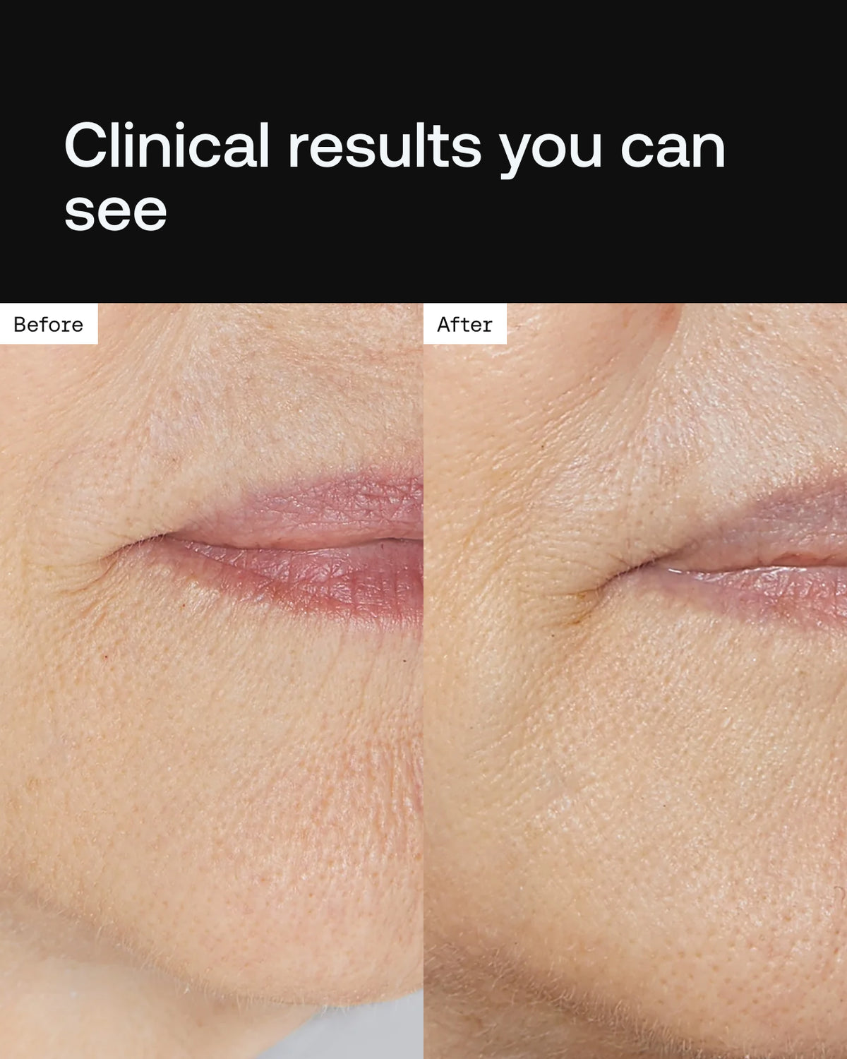 Cell Forté Serum | Human Stem Cell Conditioned Media
